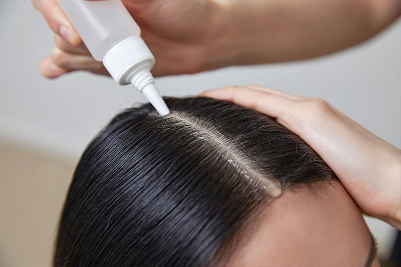 SCALP TROUBLE PT 두피 PT 시술 장면