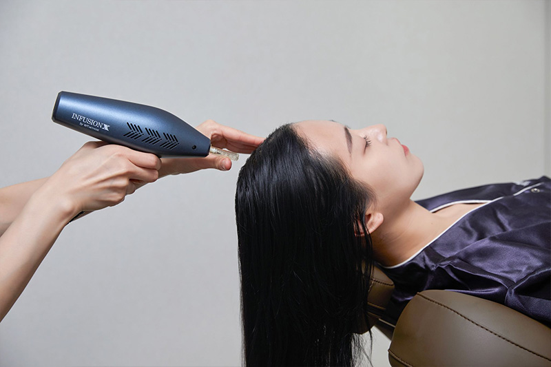 HAIR LOSS PT 두피 PT 시술 장면