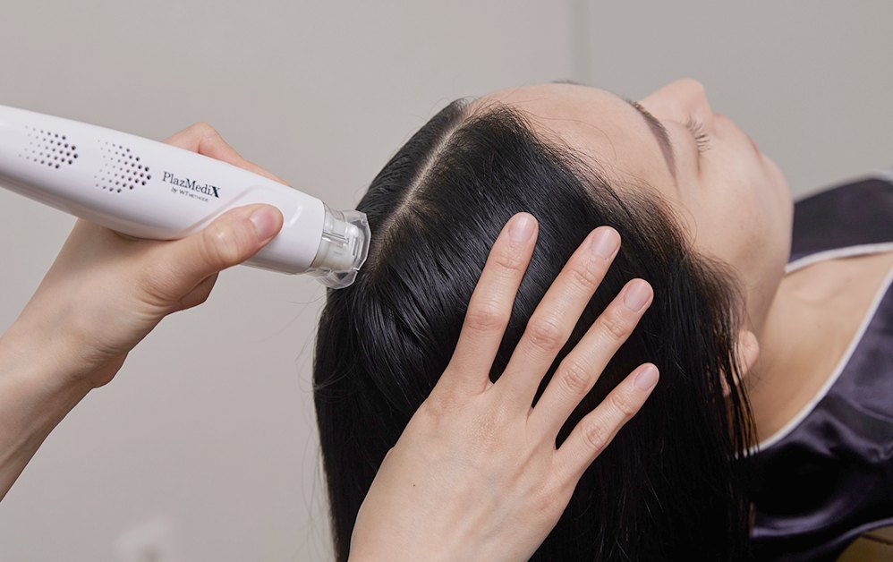 SCALP LIFT - PT 두피 리프팅 케어 시술 장면