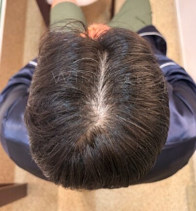 케어-전.jpg